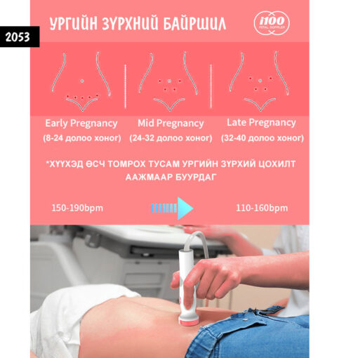 Зүрхний цохилт хэмжигч - Ургийн /#2053/ - Image 3