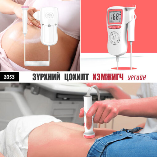 Зүрхний цохилт хэмжигч - Ургийн /#2053/